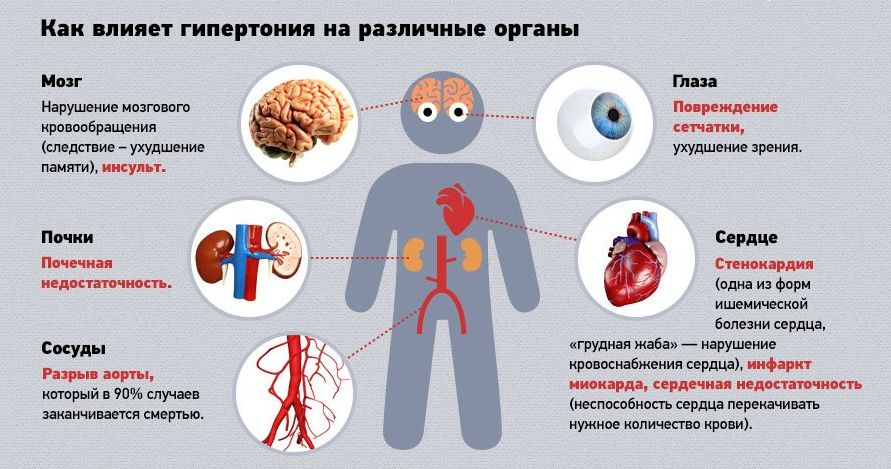 Артериальная гипертония (схема)