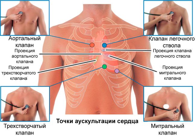 Аускультация