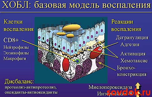 базовая модель хобл