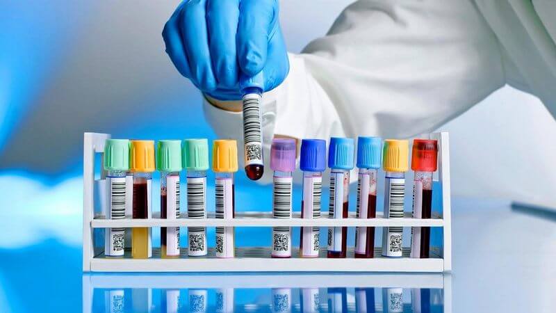 Чем опасны реактивные изменения поджелудочной железы?