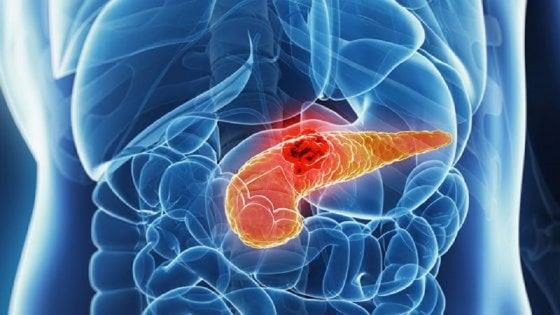 Что такое гипофункция и гиперфункция поджелудочной железы?