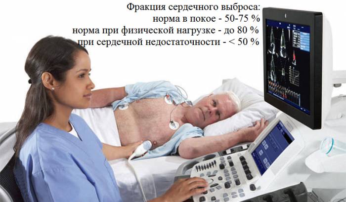 Для определения показателей насосной функции миокарда нужна эхокардиограмма