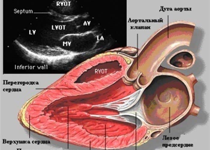 Эхокардиография