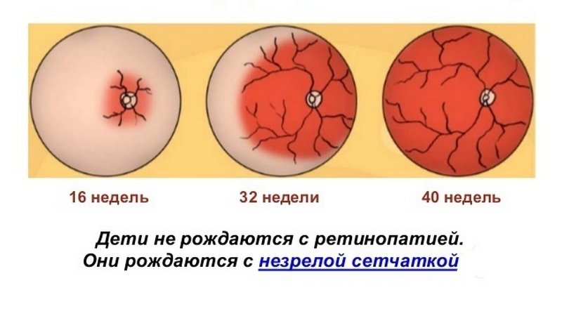 Этапы васкуляризации сетчатки плода