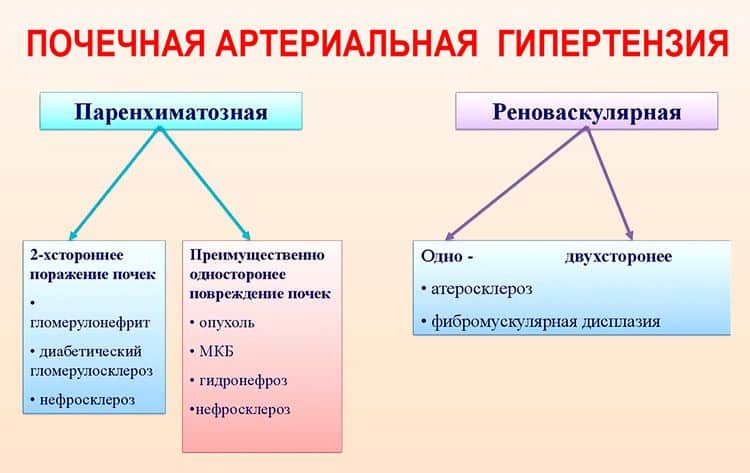 Этиология почечной гипертензии