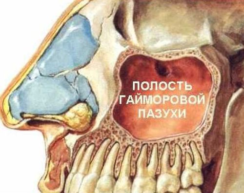 Гайморовы пазухи