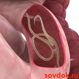 гельминты
