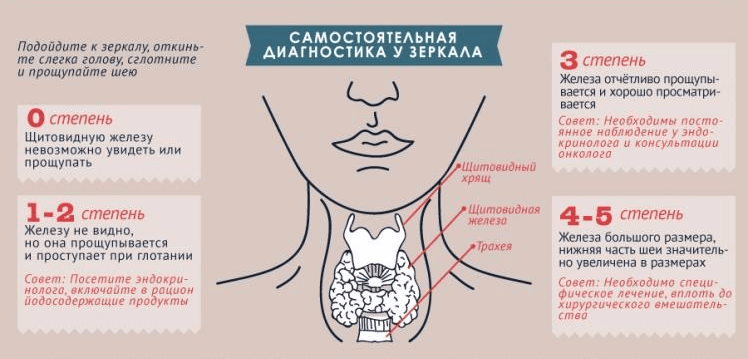 Памятка по диагностике гипотиреоза