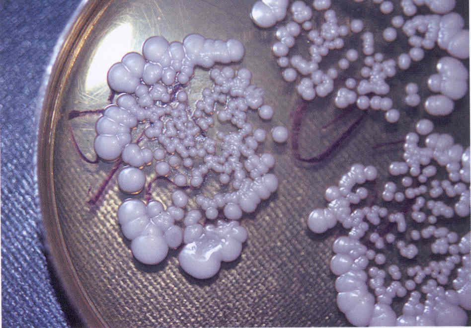 Колонии Candida