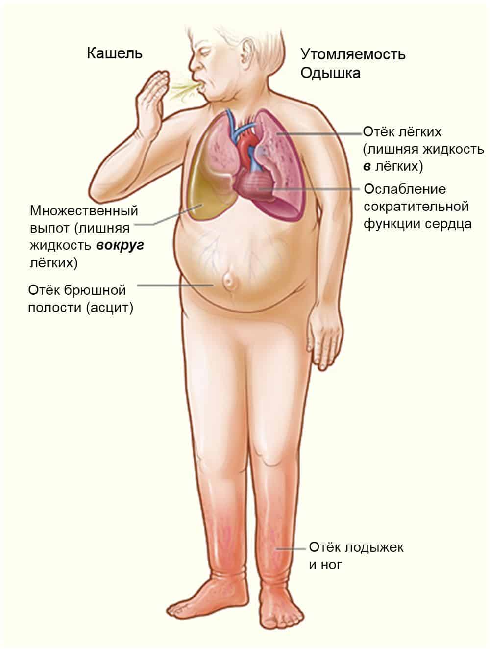 Характерные признаки недостаточности функции сердца