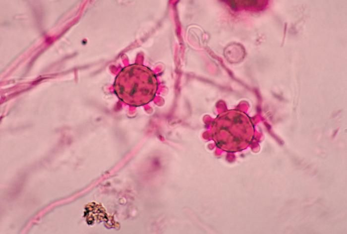 Грибок Histoplasma capsulatum