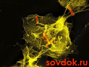 иммунная реакция