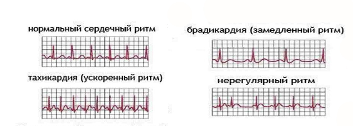 Изображение ЭКГ-снимков