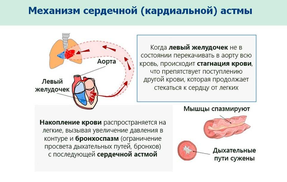 Как развивается СА