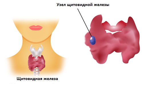Как выглядит узел