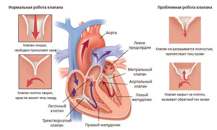 Клапаны