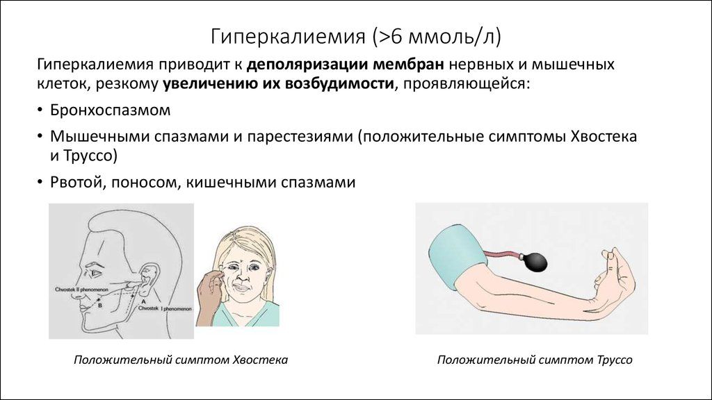 Клинические признаки повышений концентрации калия в плазме крови
