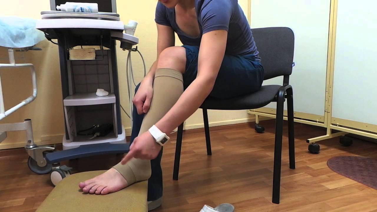 Женщина надевает компрессионный чулок