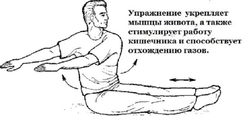 ЛФК при мегаколоне