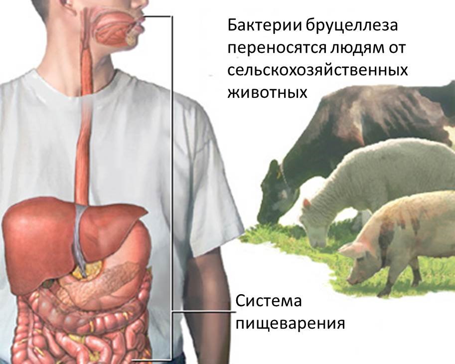 Механизм заражения человека бруцеллёзом