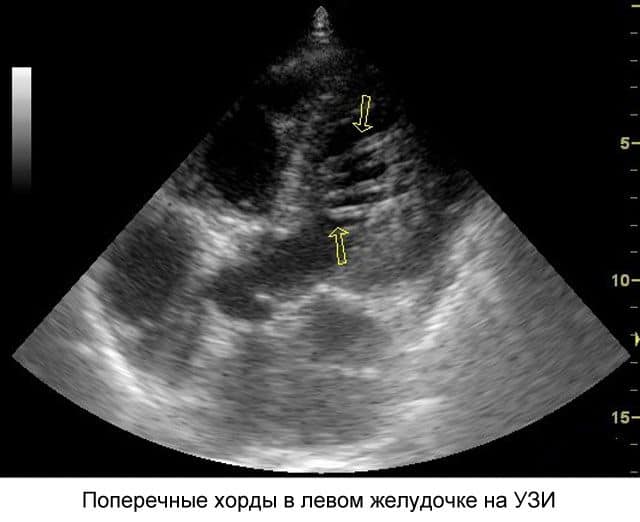 На исследования видна проблема