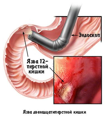 исследование желудка