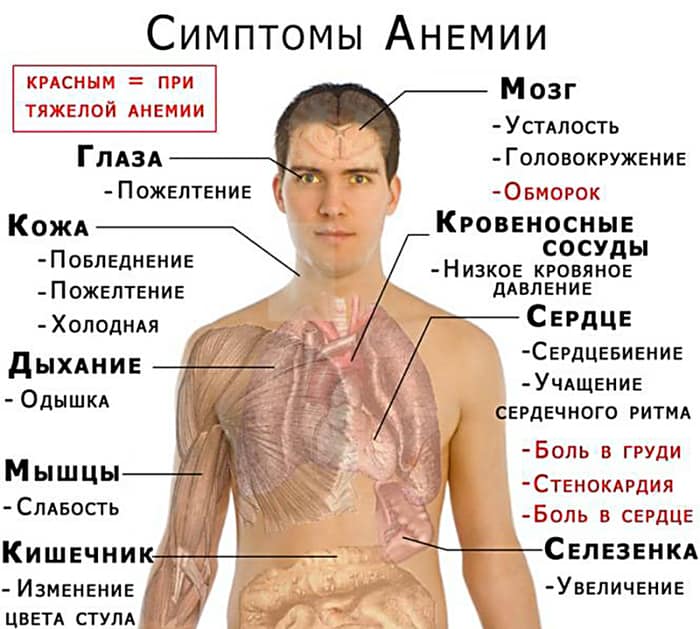 Одышка – один из признаков анемии
