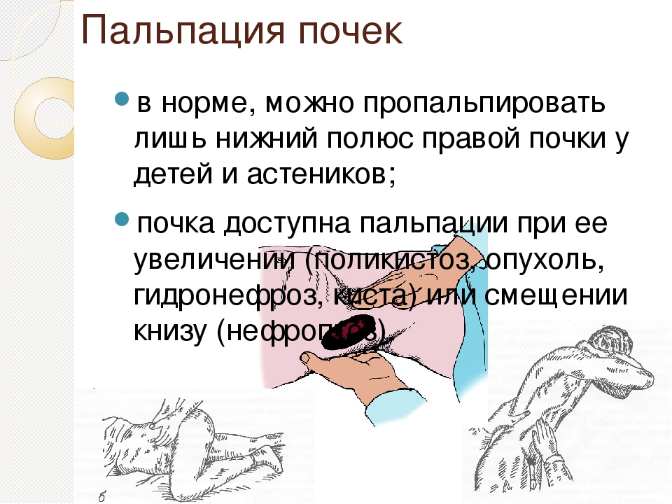 Пальпация почек