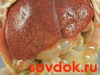 печень при ВГА