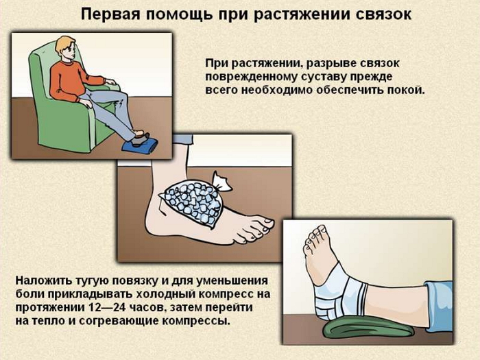 Первая помощь при растяжении