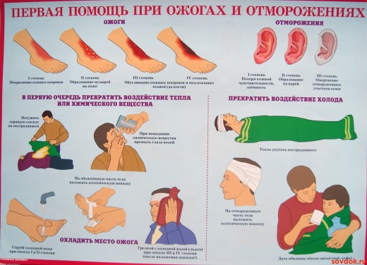 первая помощь при ожогах