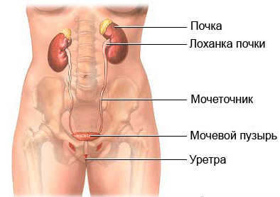 Пиелонефрит