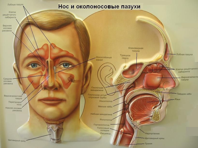 Полисинусит