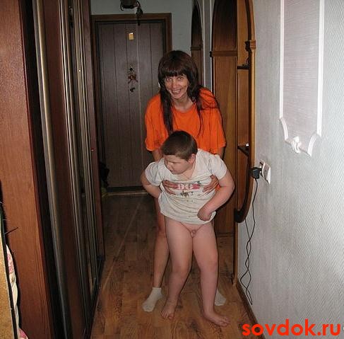 последствия герпетического энцефалита