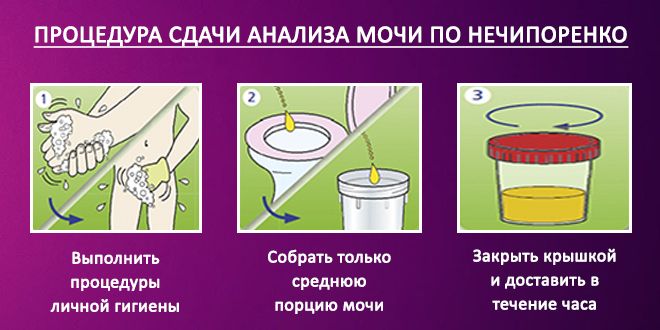 Инструкция по сбору мочи