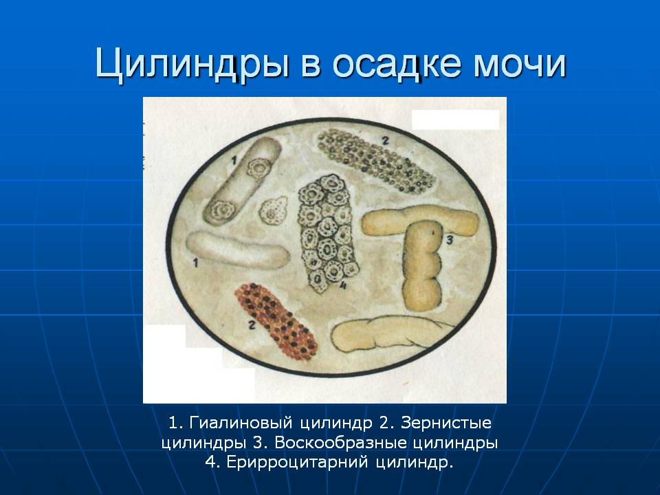 Элементы в осадке мочи