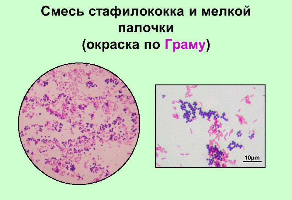 Окраска микробов по Граму