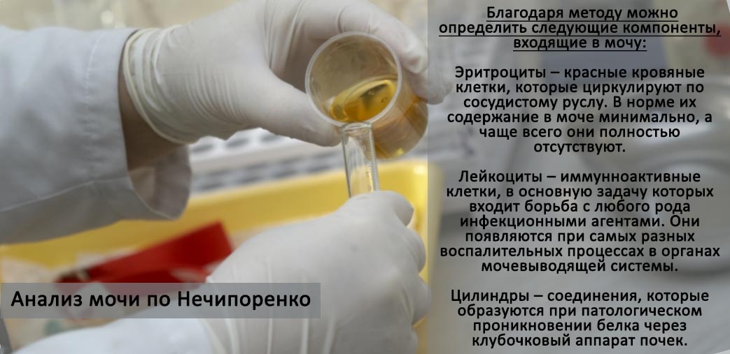 Что показывает анализ мочи по Нечипоренко