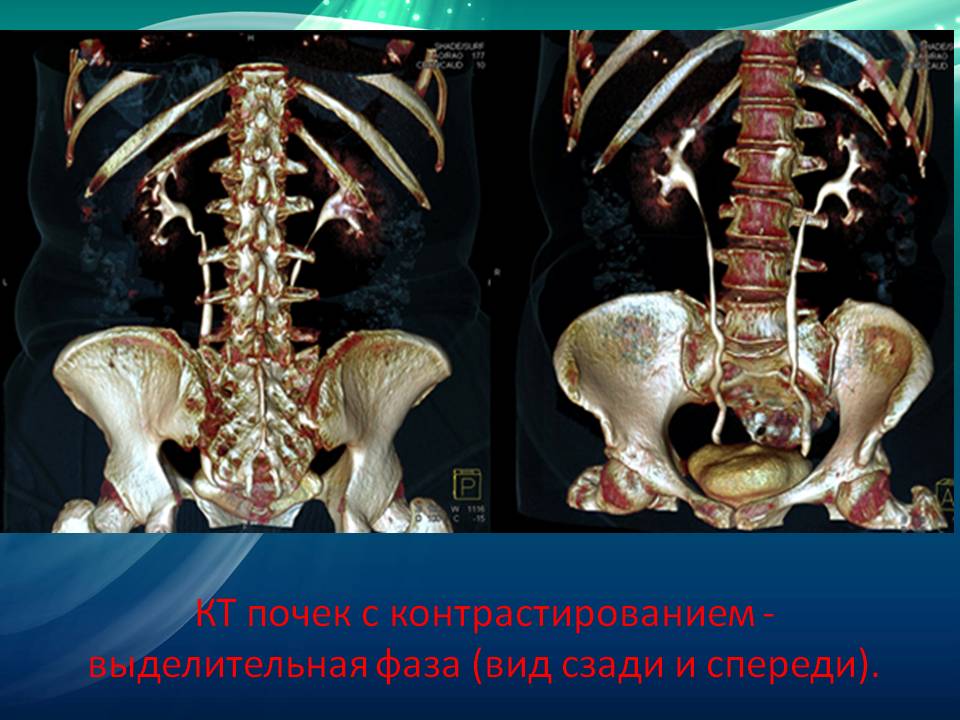 КТ с контрастированием