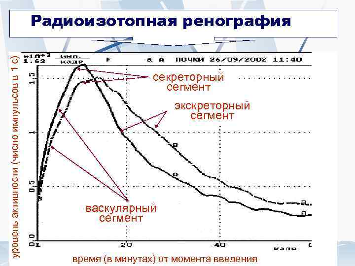 Радиоизотопная ренография (график)