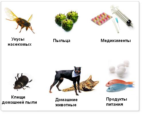 Причины аллергии