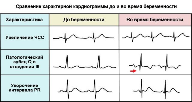 Пример исследования до и во время беременности