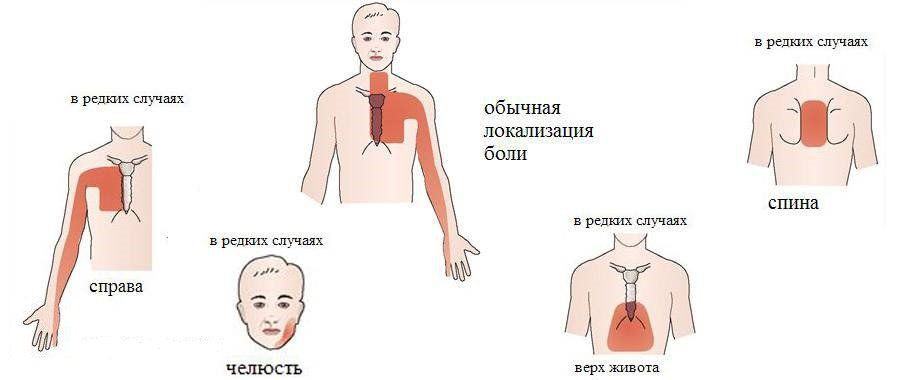 Приступ можно определить у себя по нескольким признакам