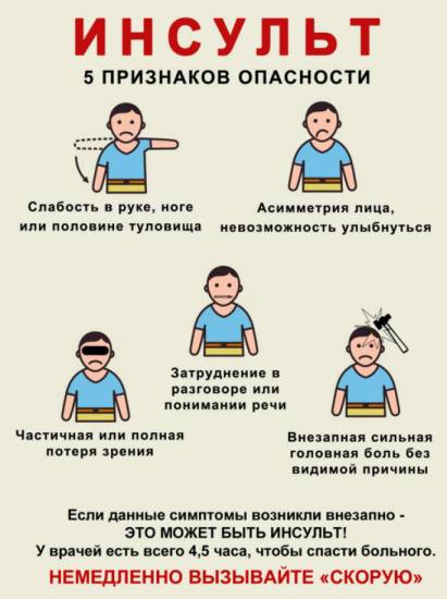 Признаки инсульта