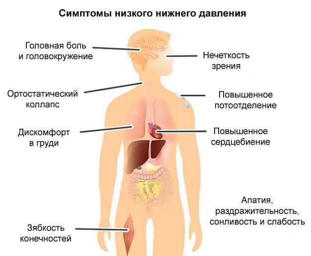 Признаки низкого давления