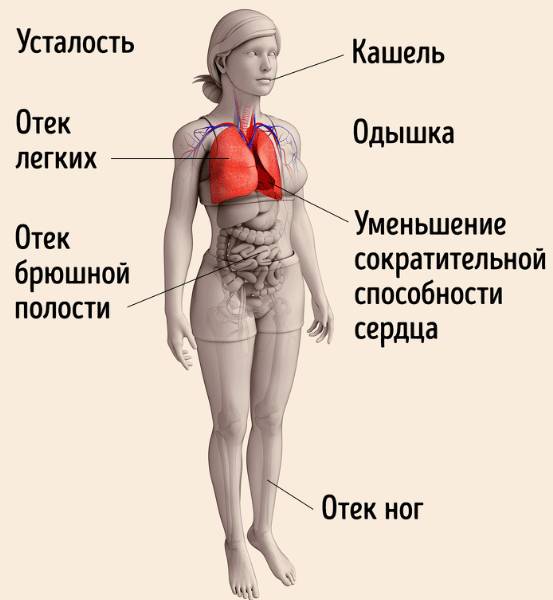 Признаки сердечной недостаточности