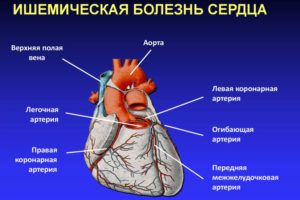 Прогрессирующая тахикардия