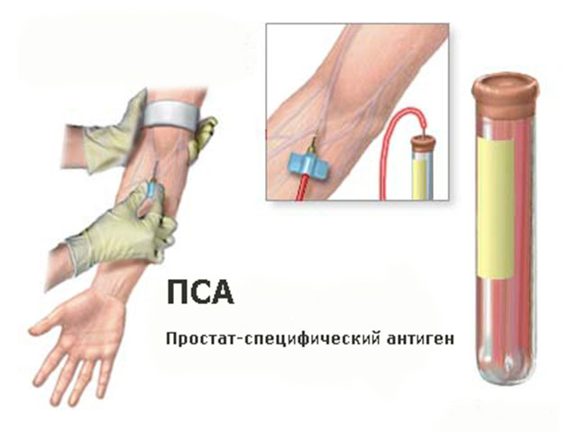 ПСА