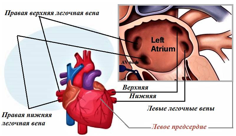 Расположение устьев легочных вен