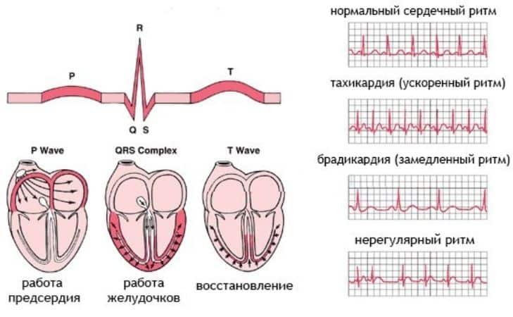 Расшифровка ЭКГ и виды сердечного ритма на ЭКГ при ССЗ